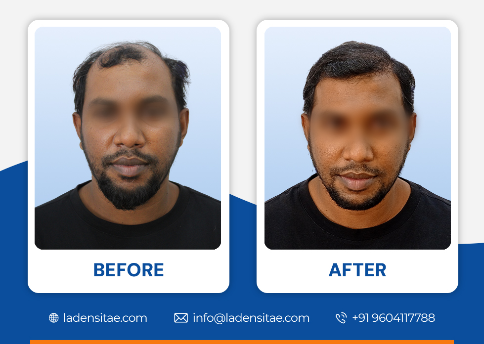Before_and_After_Image_01