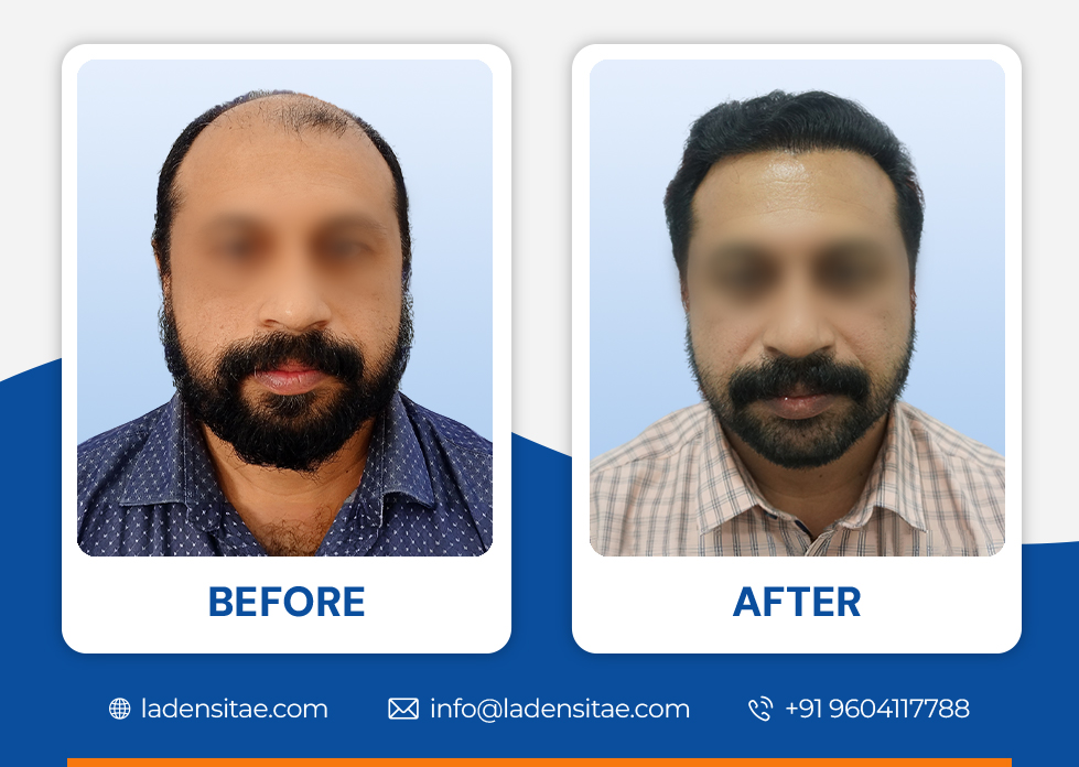Before_and_After_Image_02