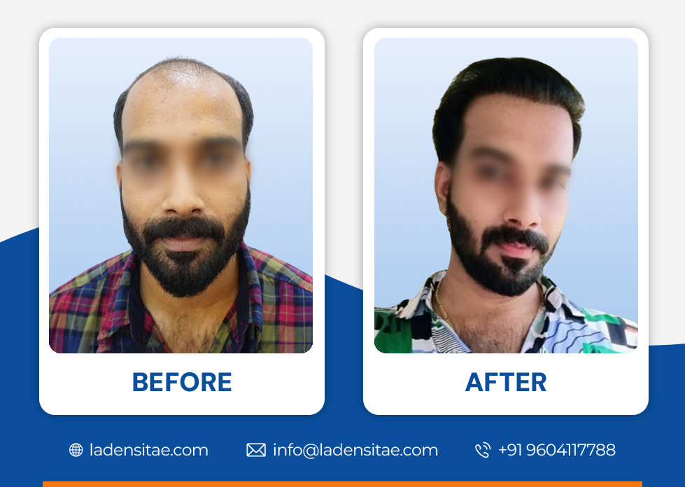 Before_and_After_Image_03