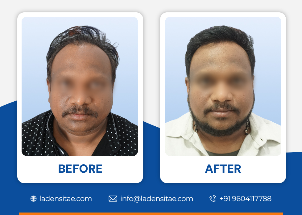 Before_and_After_Image_04