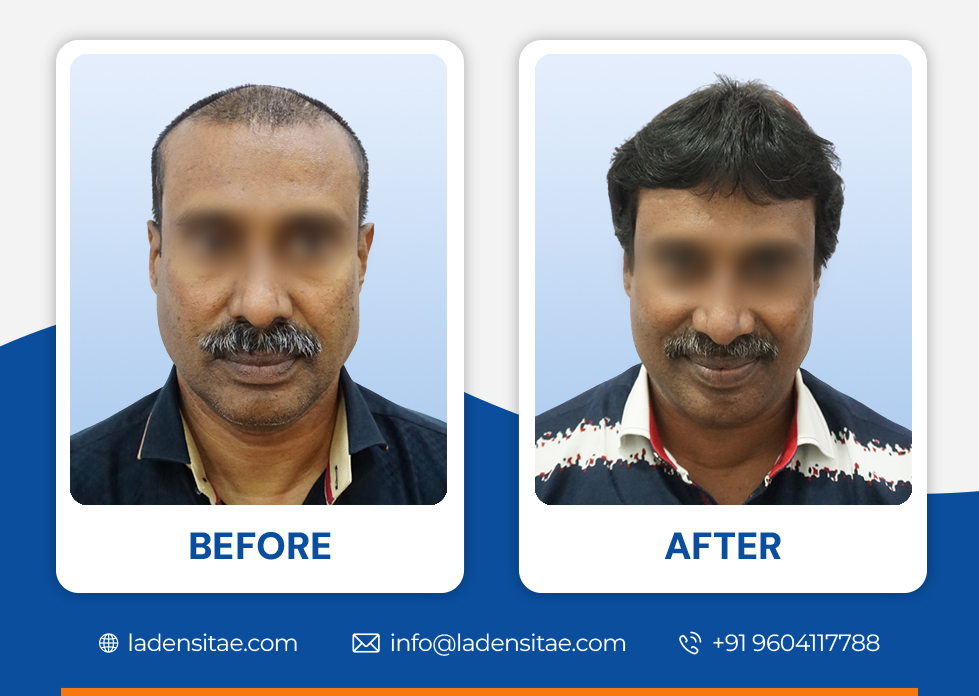Before_and_After_Image_05