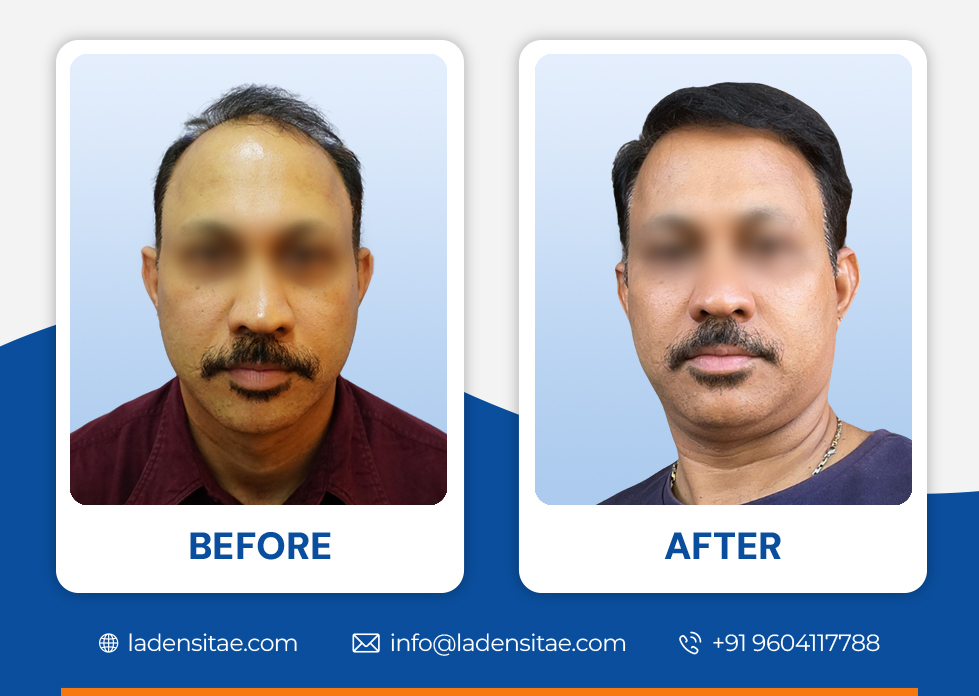 Before_and_After_Image_06