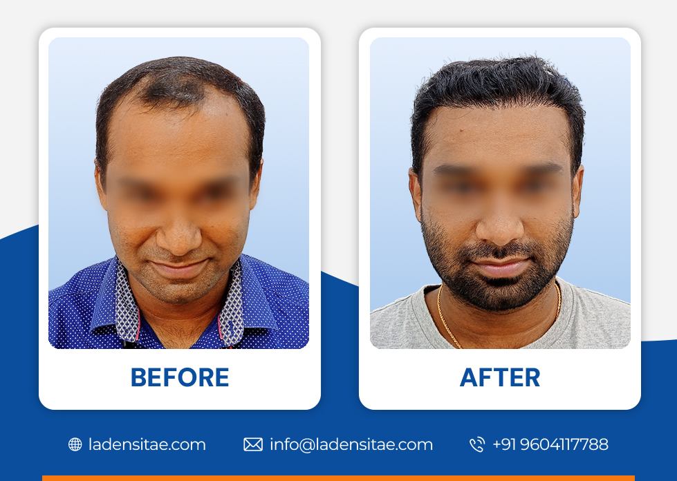 Before_and_After_Image_07