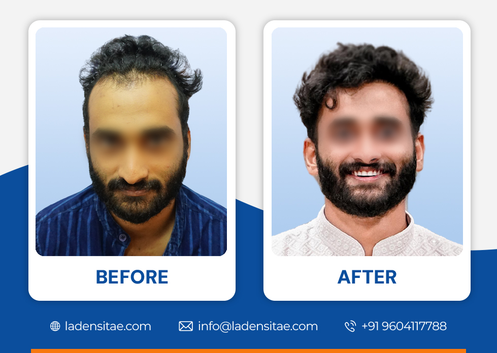 Before_and_After_Image_09