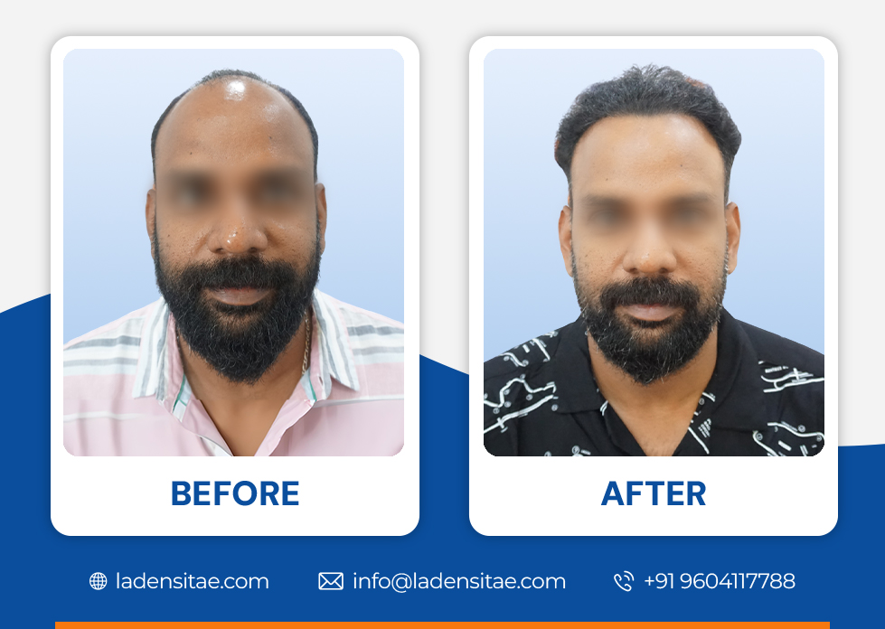 Before_and_After_Image_10